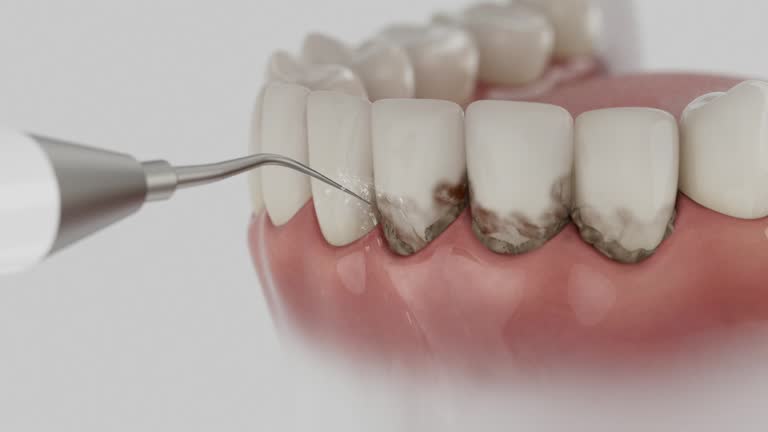 Trusted Teeth Cleaning And Checkup service in Fortville, IN - Dentist Open Now